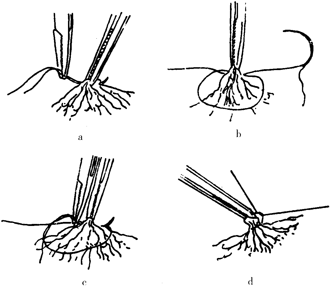 手術(shù)療法